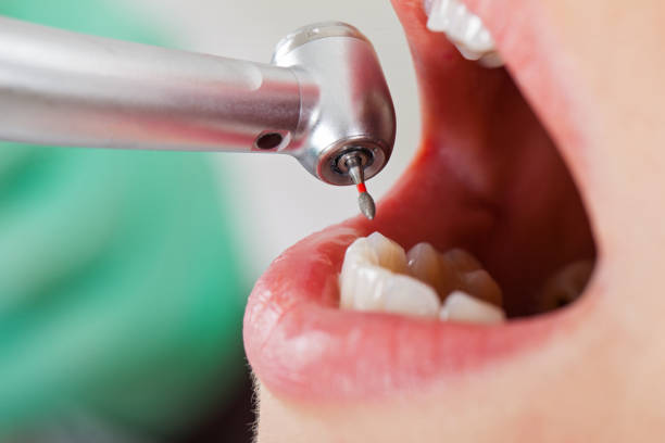 Best Emergency Treatment for Dental Infections or Abscesses in Dunean, SC